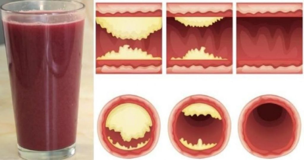 Ce délicieux jus nettoie les artères et prévient les maladies cardiaques