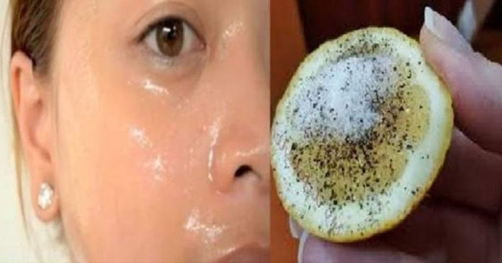 Une recette au citron pour effacer les taches du visage et avoir une peau éclatante