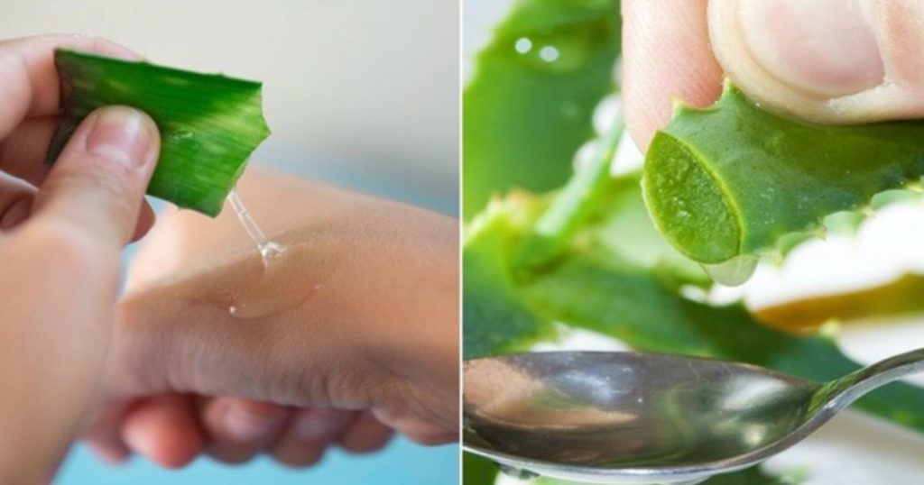 Utilisez l’aloe vera pour soigner l’eczéma le psoriasis la dermatite atopique et autres allergies cutanées